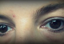 Muče vas podočnjaci? Sve što trebate, imate u kuhinji!