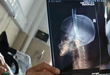 Bezbrižno se šetao kada mu je kuhinjski nož pao na glavu!