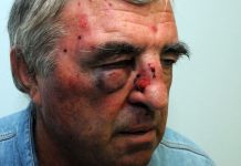 Na svojoj zemlji zatekao ilegalne berače smilja, pa ga namlatili ko’ vola u kupusu!