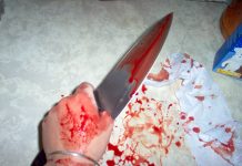 Mađarica na Viru nožem izbola muškarca